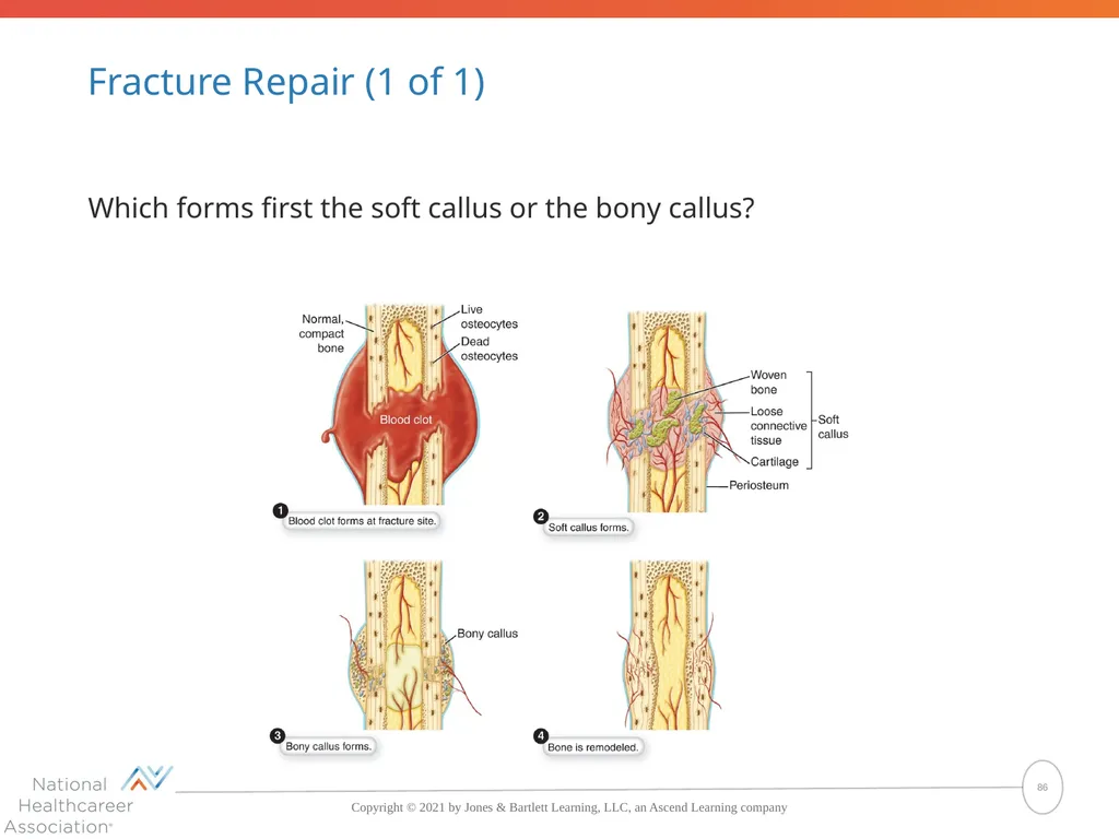 The Skeletal System: Bones and Joints Copyright © - slide 86 of 88