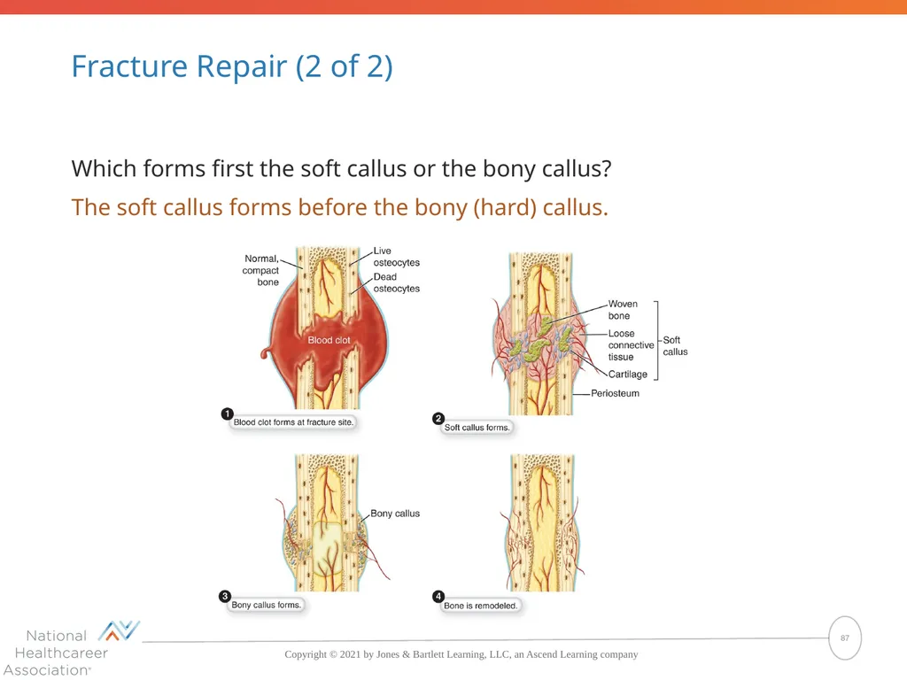 The Skeletal System: Bones and Joints Copyright © - slide 87 of 88