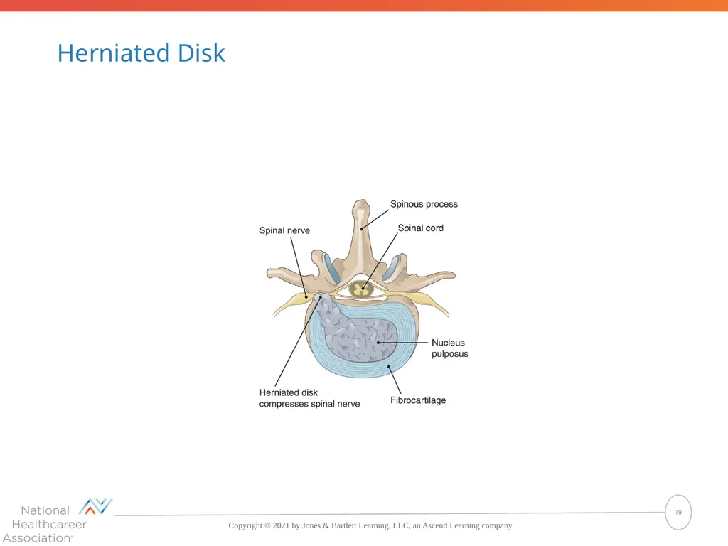The Skeletal System: Bones and Joints Copyright © - slide 79 of 88