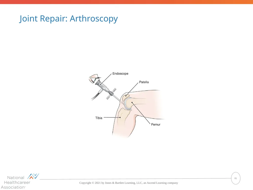 The Skeletal System: Bones and Joints Copyright © - slide 81 of 88