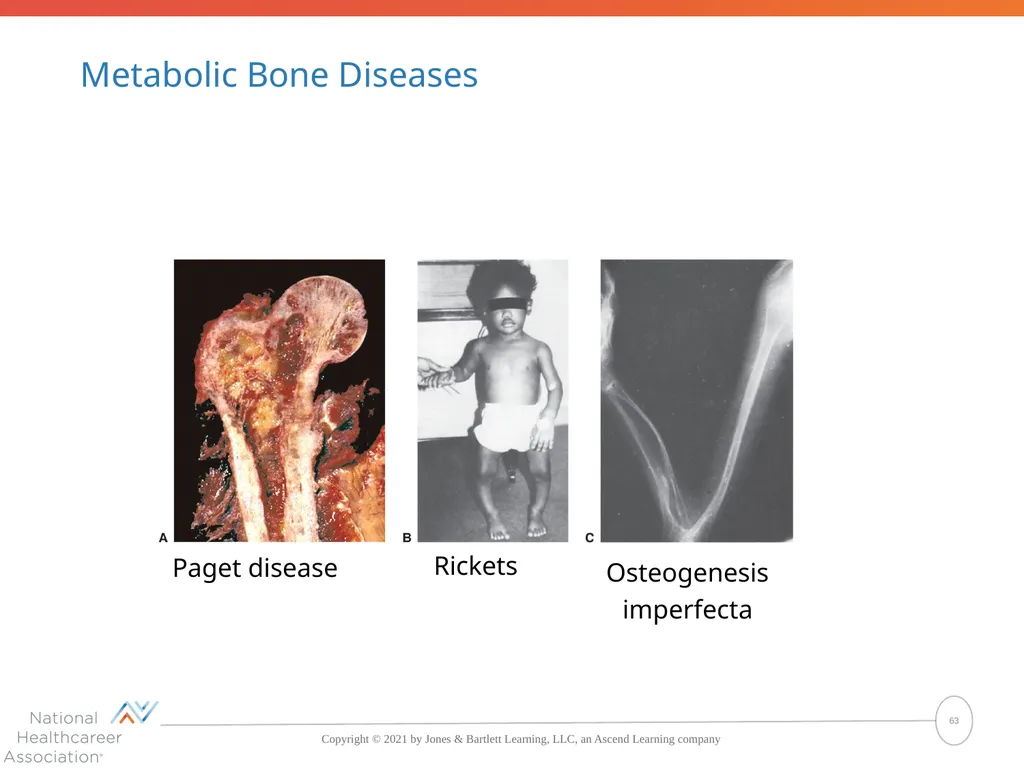 The Skeletal System: Bones and Joints Copyright © - slide 63 of 88