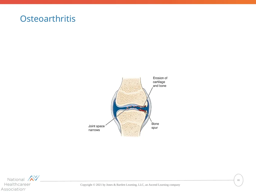 The Skeletal System: Bones and Joints Copyright © - slide 80 of 88