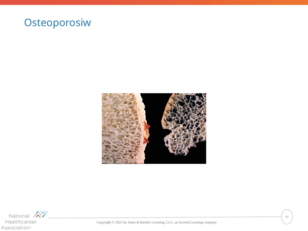 The Skeletal System: Bones and Joints Copyright © - slide 62 of 88