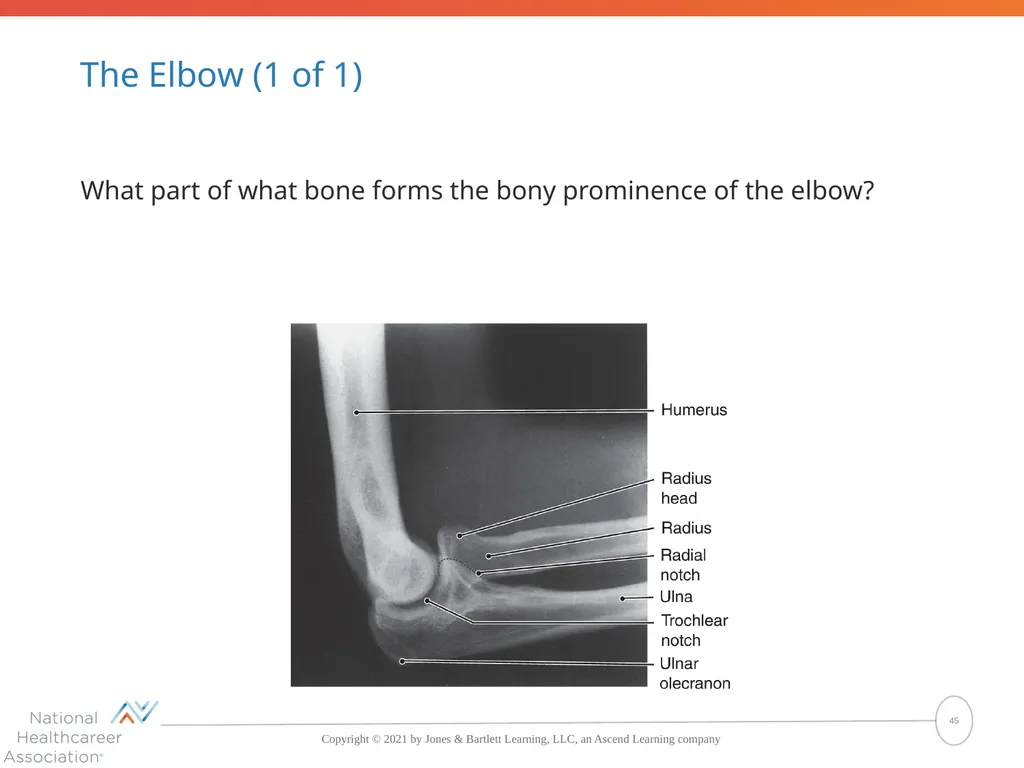 The Skeletal System: Bones and Joints Copyright © - slide 45 of 88