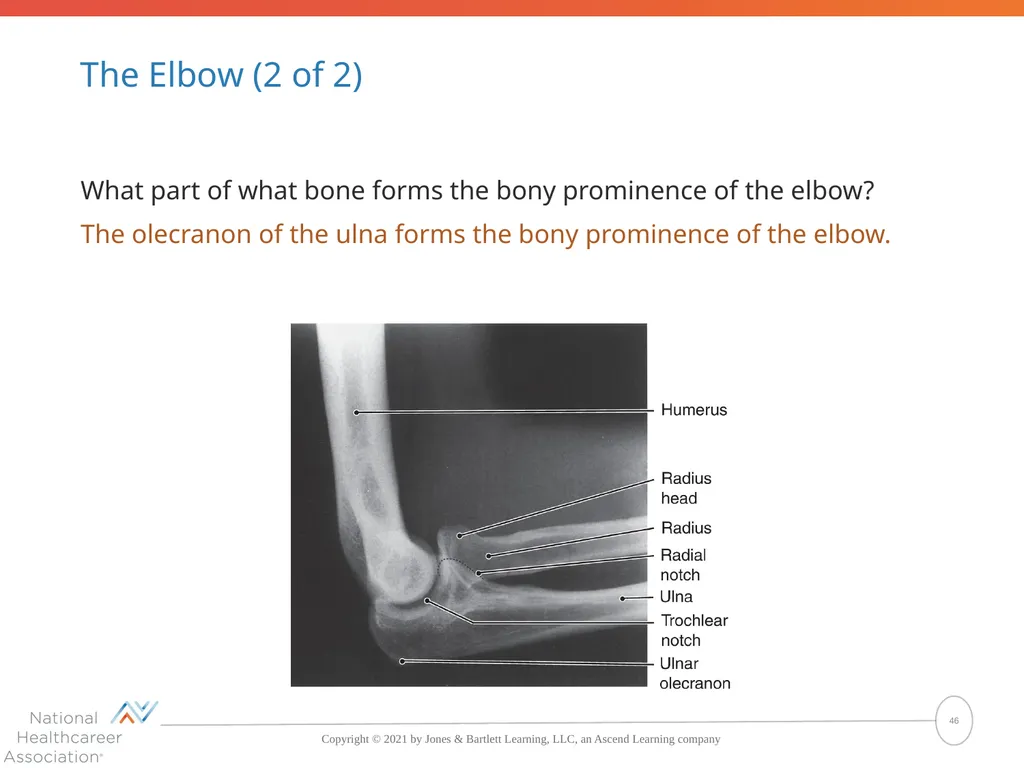 The Skeletal System: Bones and Joints Copyright © - slide 46 of 88