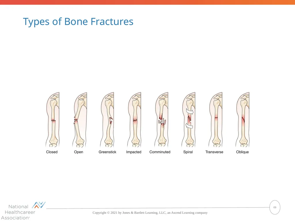 The Skeletal System: Bones and Joints Copyright © - slide 69 of 88