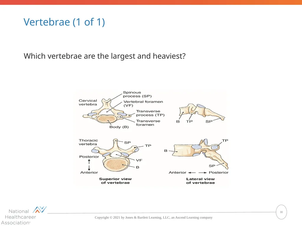 The Skeletal System: Bones and Joints Copyright © - slide 30 of 88