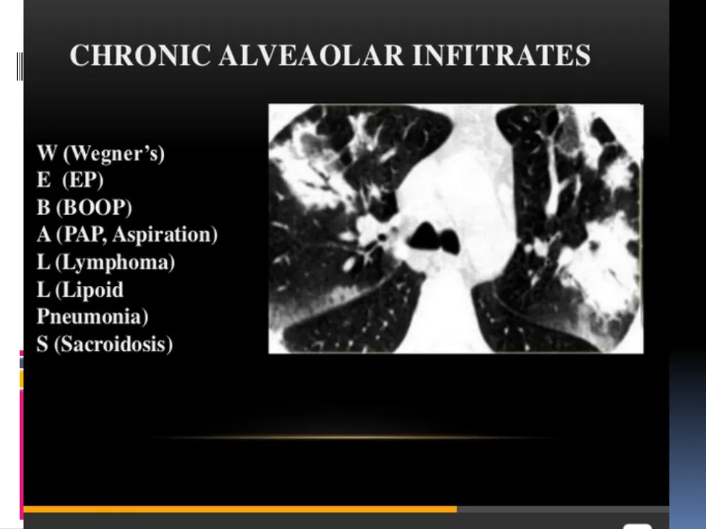 APPROCH TO THE PT WITH INTERSTITIAL LUNG DISEASE - slide 44 of 80