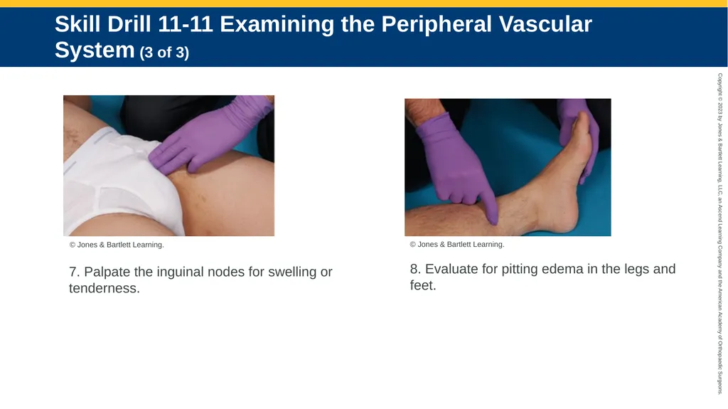 Patient Assessment CHAPTER 11 Skill Drill 11-1 - slide 34 of 40