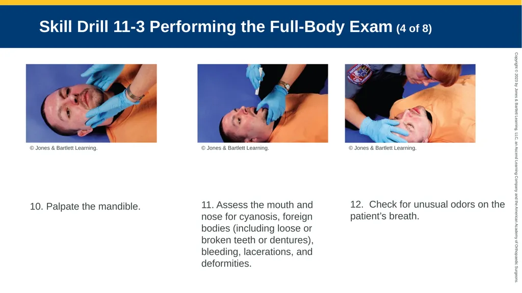 Patient Assessment CHAPTER 11 Skill Drill 11-1 - slide 10 of 40