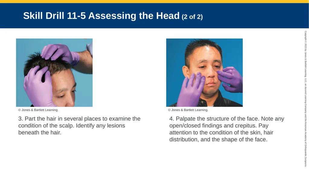 Patient Assessment CHAPTER 11 Skill Drill 11-1 - slide 18 of 40