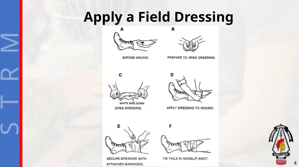Perform First Aid for Bleeding Extremity and - slide 4 of 14
