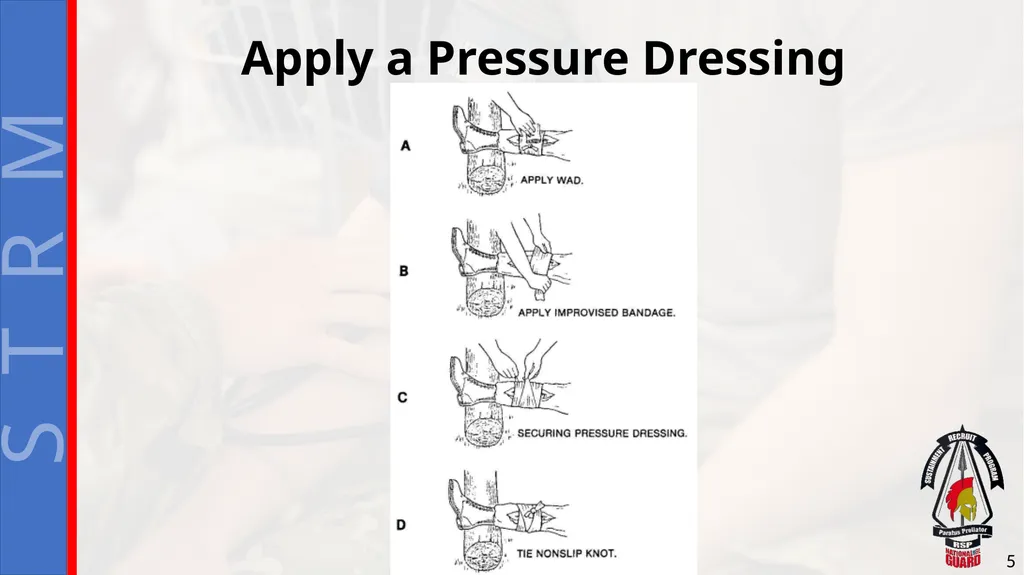 Perform First Aid for Bleeding Extremity and - slide 5 of 14