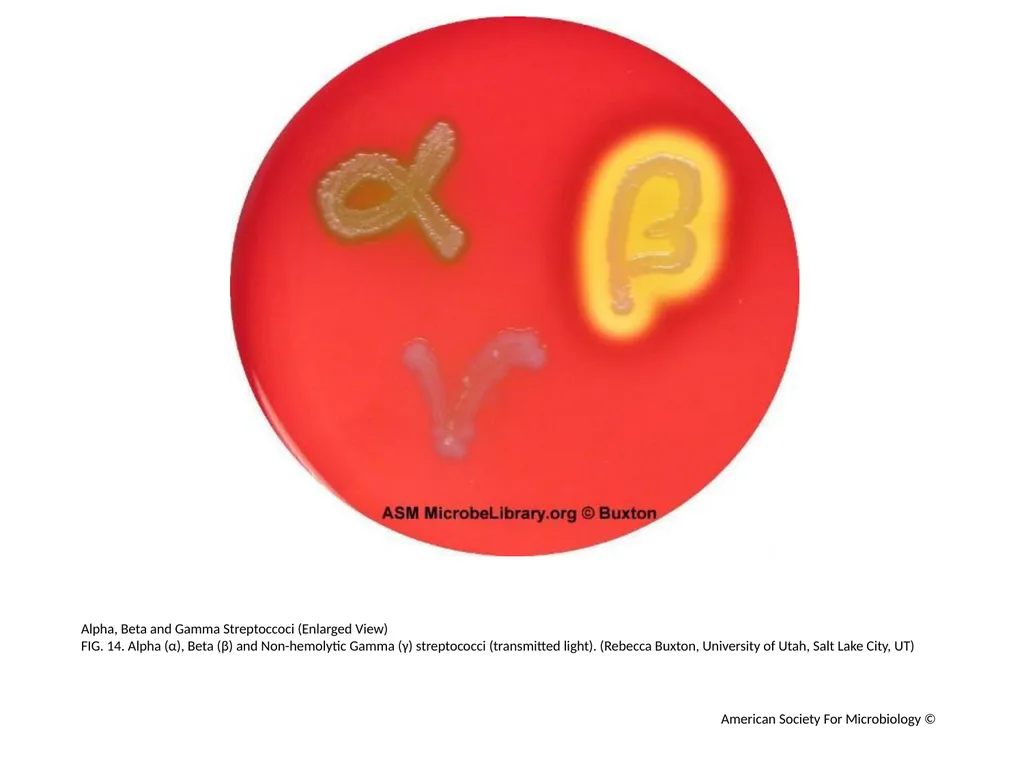 Blood Agar Plates and Hemolysis: Streptococcus - slide 15 of 44