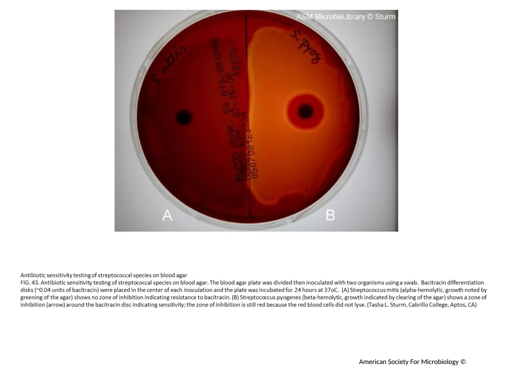 Blood Agar Plates and Hemolysis: Streptococcus - slide 44 of 44
