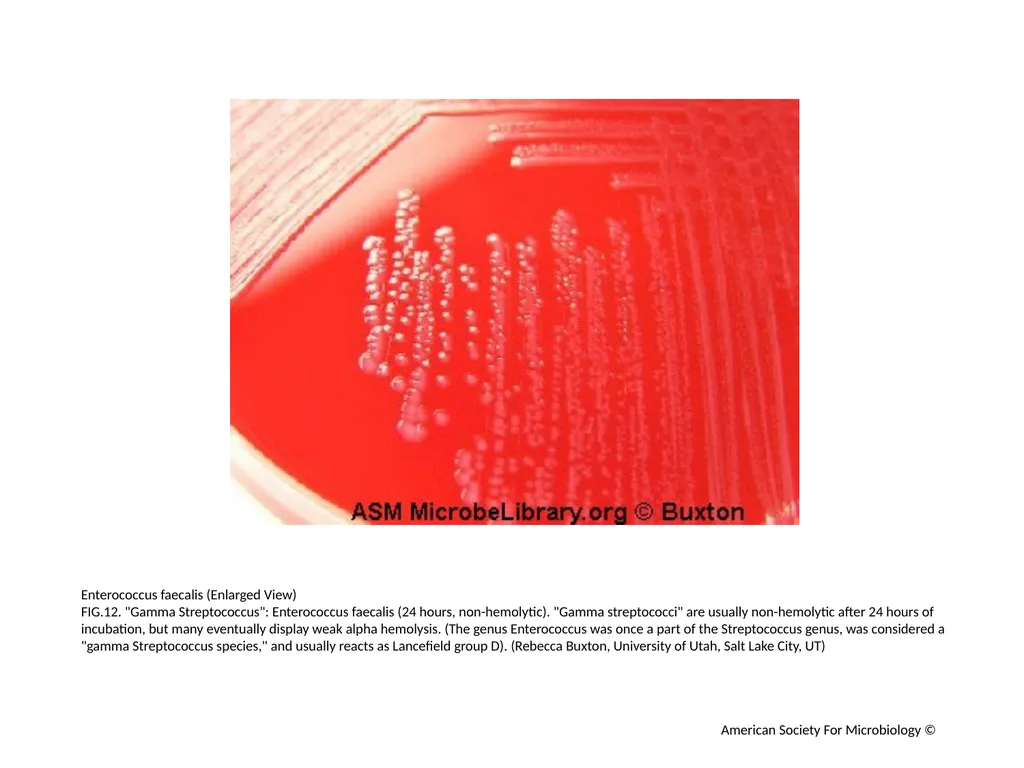 Blood Agar Plates and Hemolysis: Streptococcus - slide 13 of 44