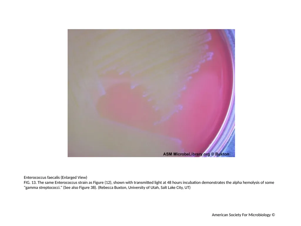 Blood Agar Plates and Hemolysis: Streptococcus - slide 14 of 44