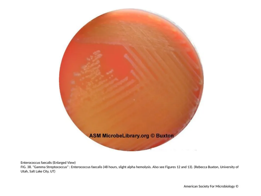 Blood Agar Plates and Hemolysis: Streptococcus - slide 39 of 44