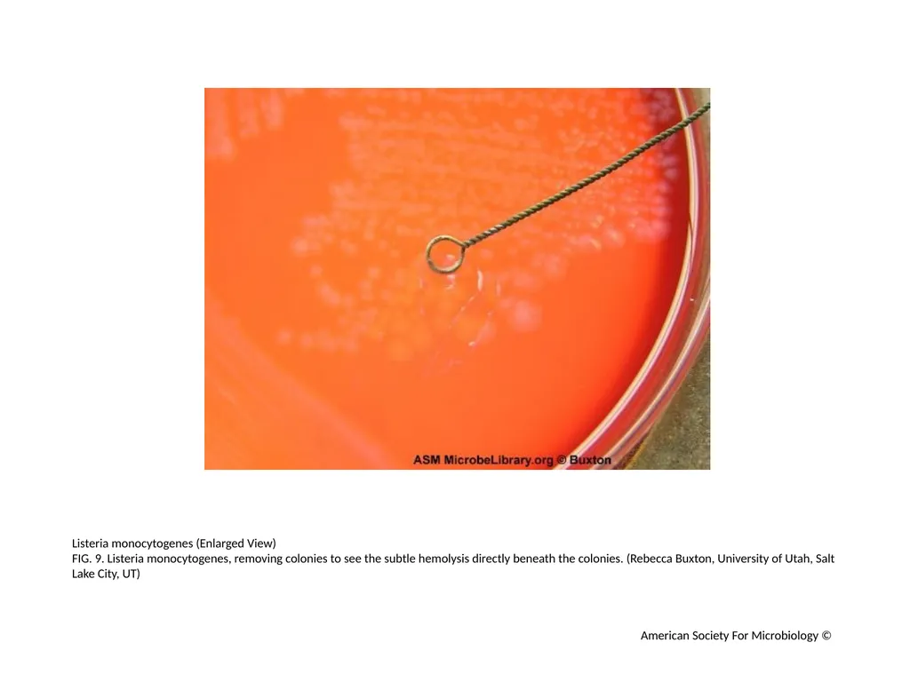 Blood Agar Plates and Hemolysis: Streptococcus - slide 10 of 44