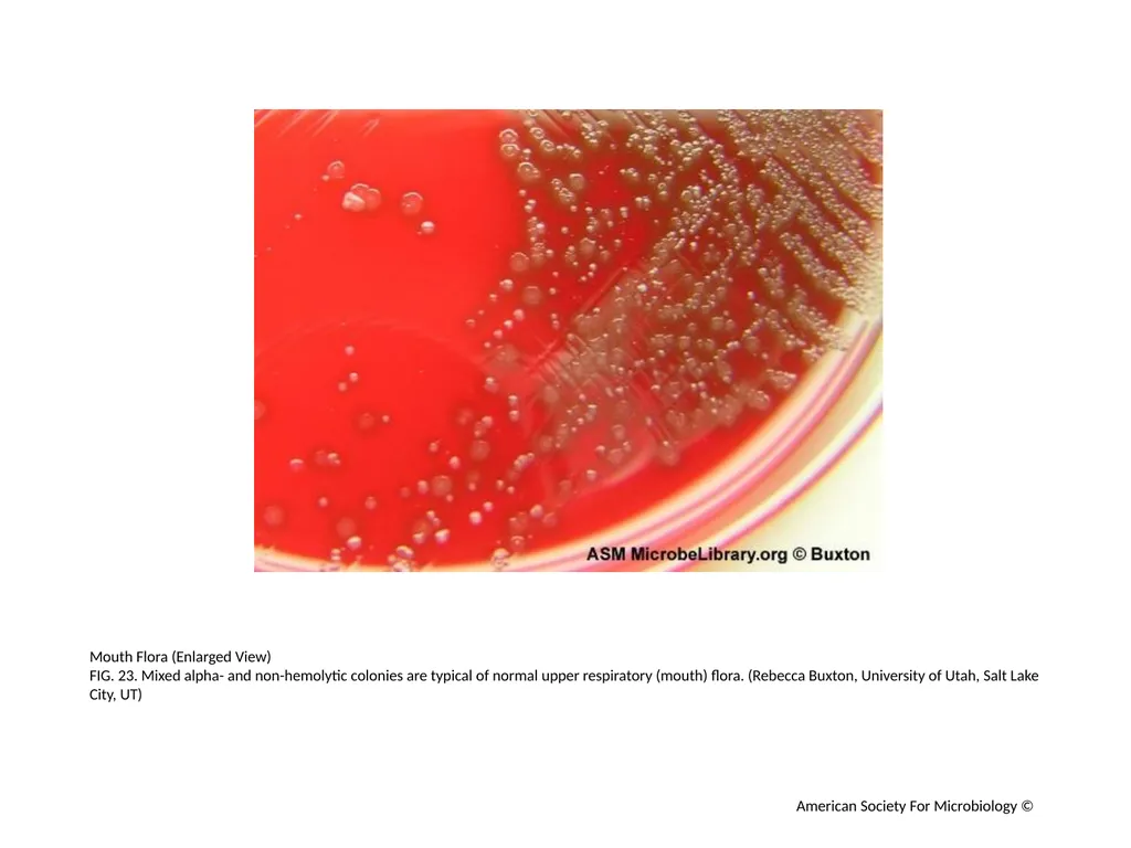Blood Agar Plates and Hemolysis: Streptococcus - slide 24 of 44