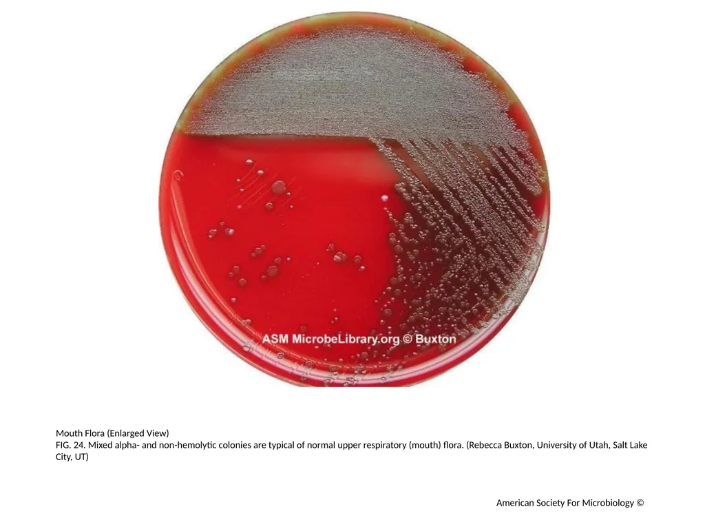 Blood Agar Plates and Hemolysis: Streptococcus - slide 25 of 44