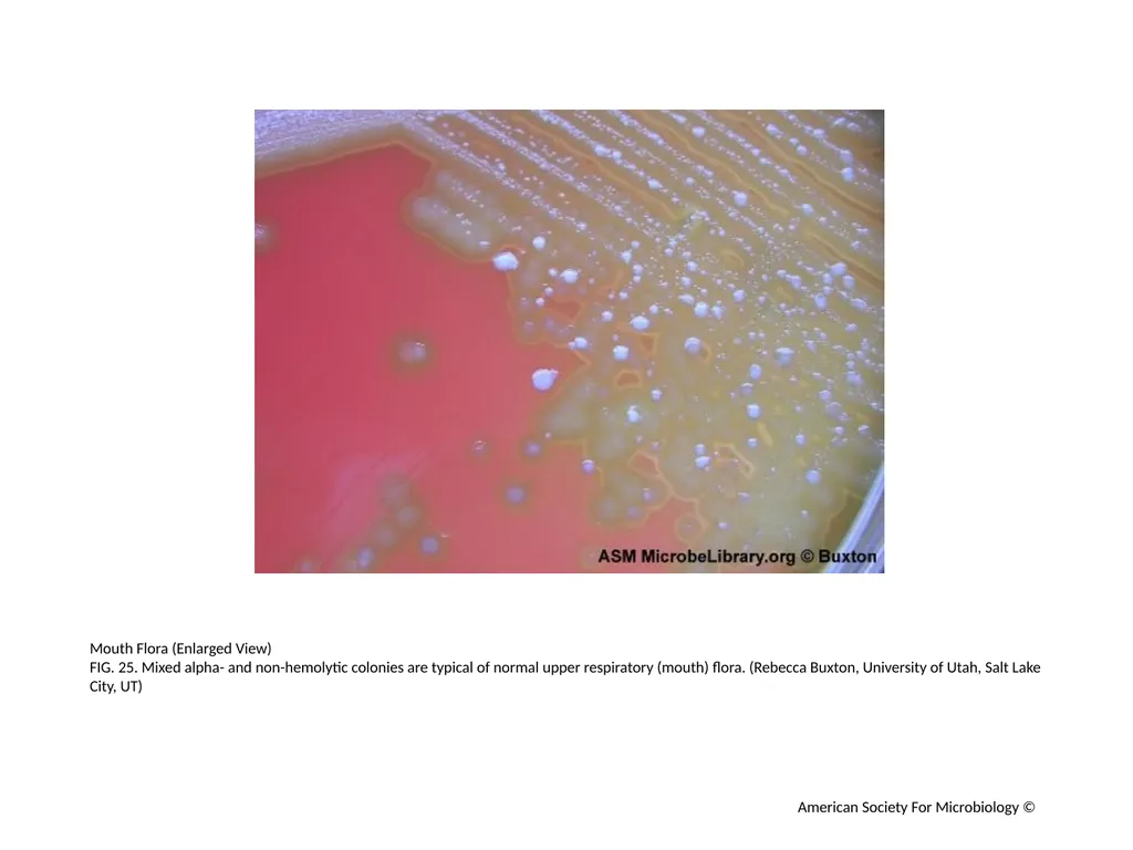 Blood Agar Plates and Hemolysis: Streptococcus - slide 26 of 44