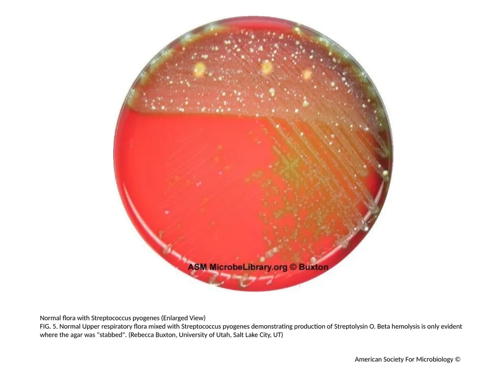 Blood Agar Plates and Hemolysis: Streptococcus - slide 6 of 44
