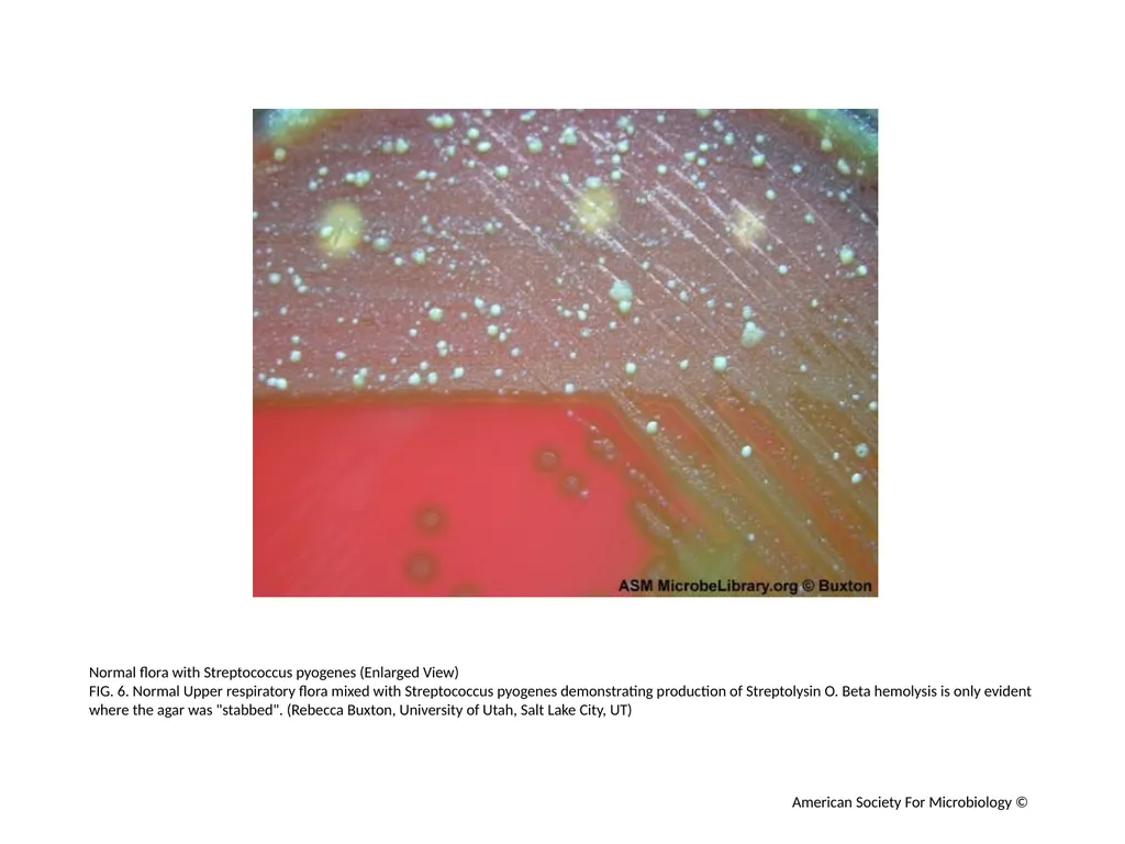 Blood Agar Plates and Hemolysis: Streptococcus - slide 7 of 44
