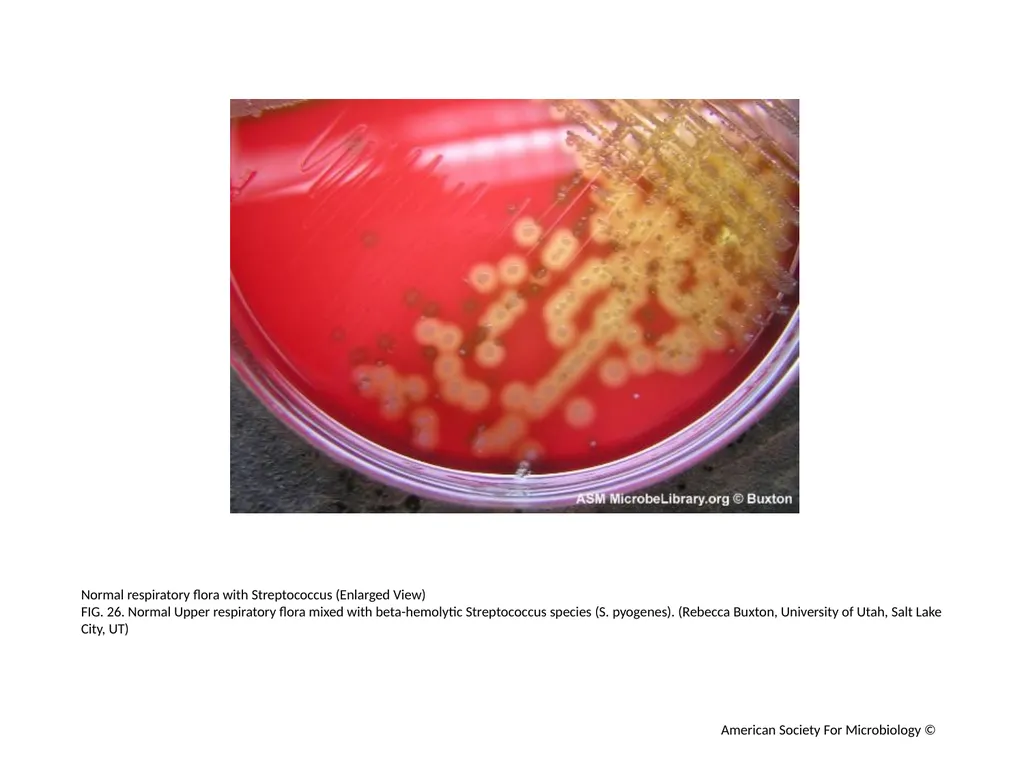 Blood Agar Plates and Hemolysis: Streptococcus - slide 27 of 44