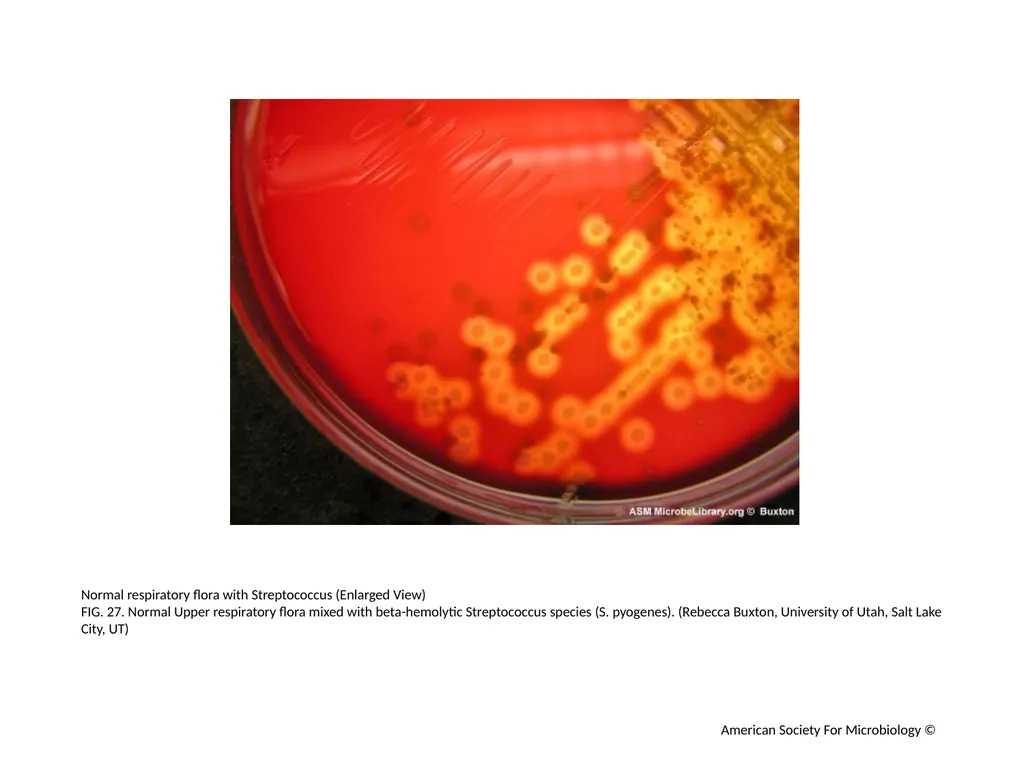 Blood Agar Plates and Hemolysis: Streptococcus - slide 28 of 44