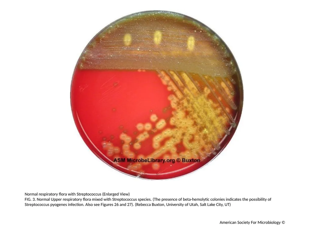 Blood Agar Plates and Hemolysis: Streptococcus - slide 4 of 44