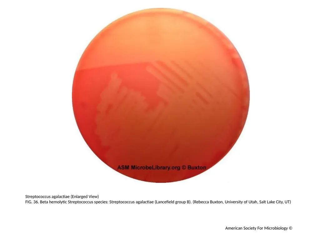 Blood Agar Plates and Hemolysis: Streptococcus - slide 37 of 44