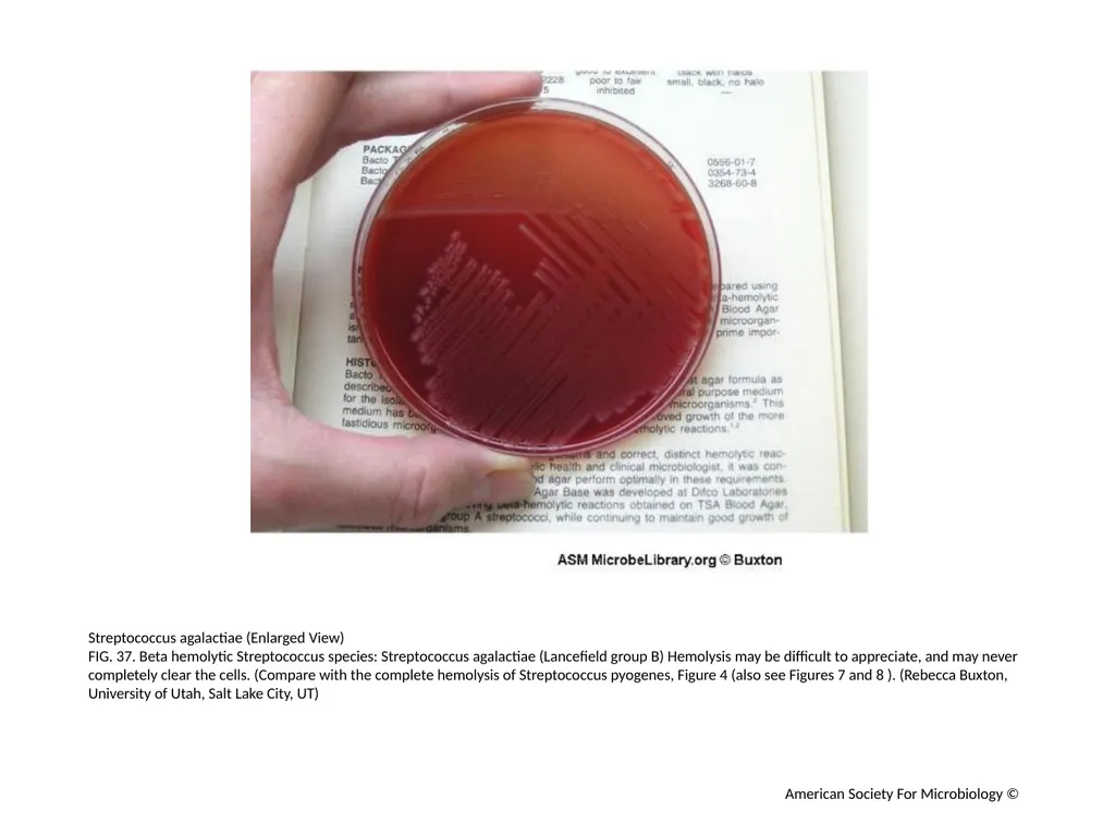 Blood Agar Plates and Hemolysis: Streptococcus - slide 38 of 44