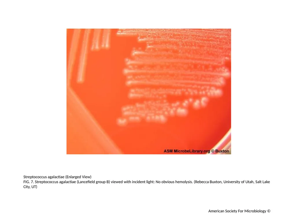Blood Agar Plates and Hemolysis: Streptococcus - slide 8 of 44