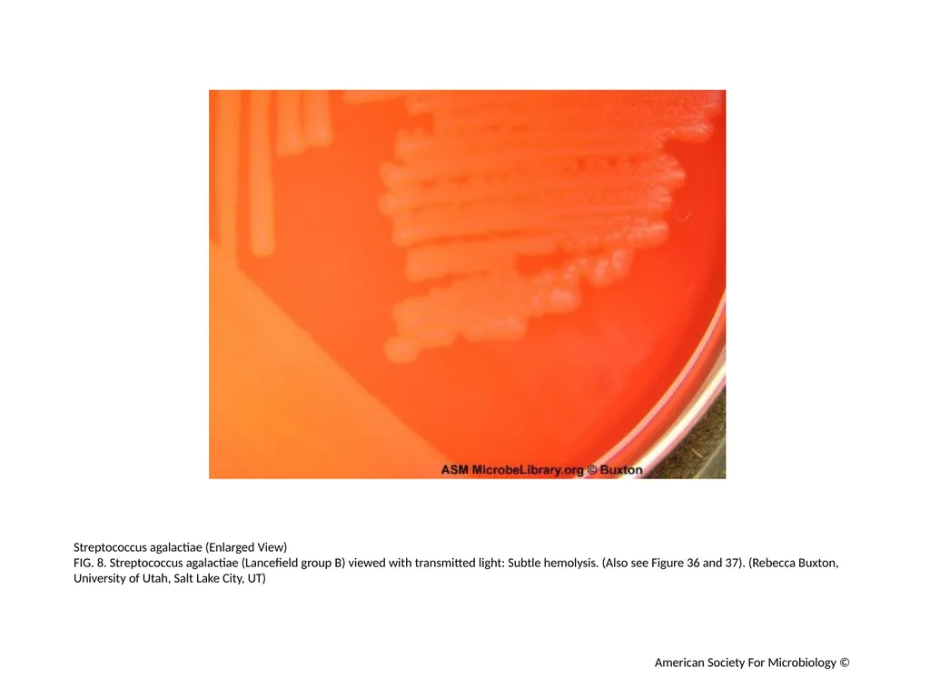 Blood Agar Plates and Hemolysis: Streptococcus - slide 9 of 44