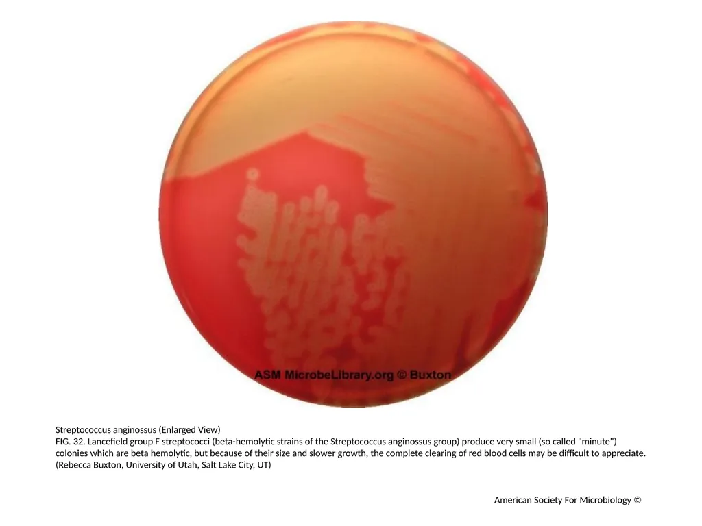 Blood Agar Plates and Hemolysis: Streptococcus - slide 33 of 44