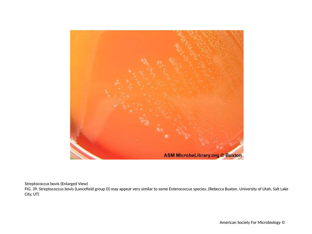 Blood Agar Plates and Hemolysis: Streptococcus - slide 40 of 44