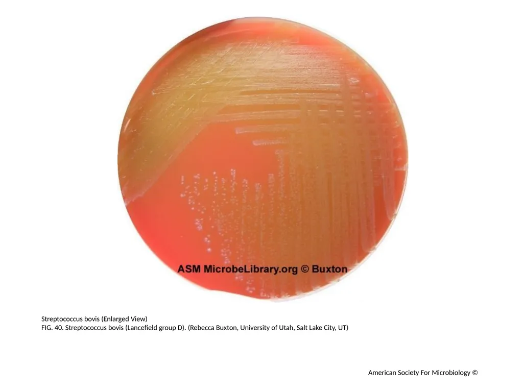 Blood Agar Plates and Hemolysis: Streptococcus - slide 41 of 44