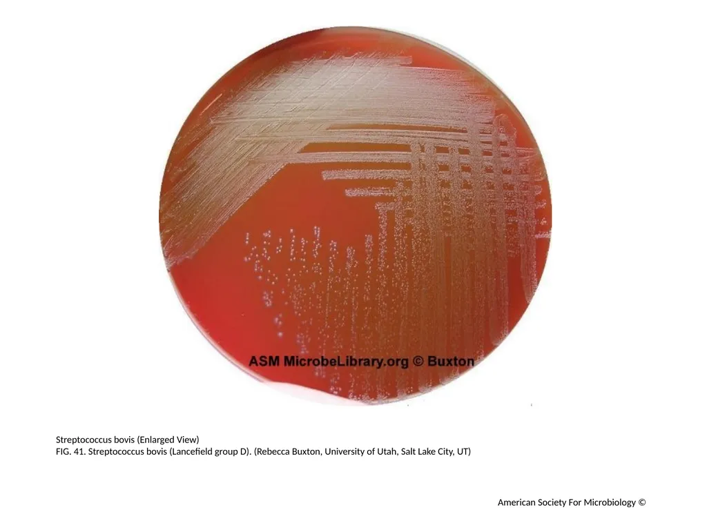Blood Agar Plates and Hemolysis: Streptococcus - slide 42 of 44