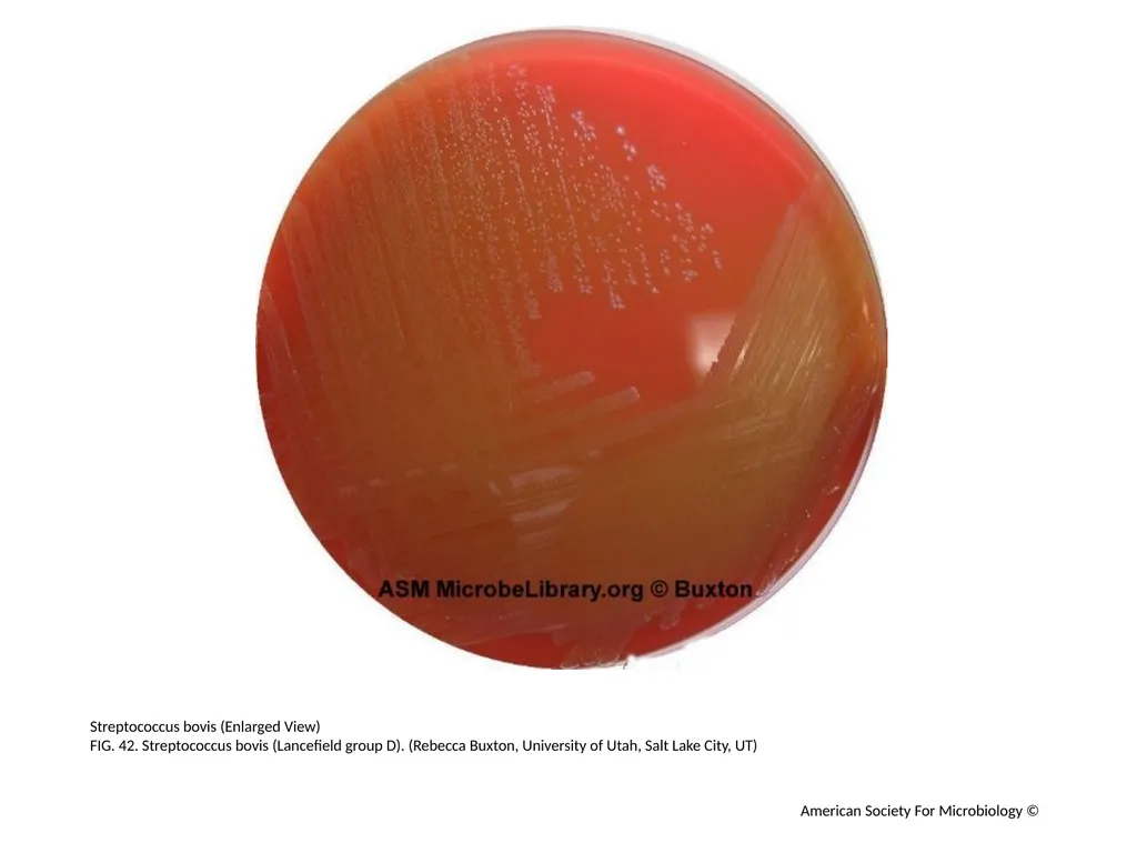 Blood Agar Plates and Hemolysis: Streptococcus - slide 43 of 44