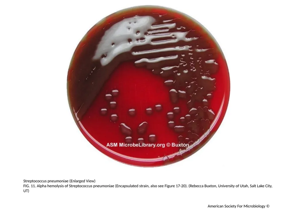 Blood Agar Plates and Hemolysis: Streptococcus - slide 12 of 44