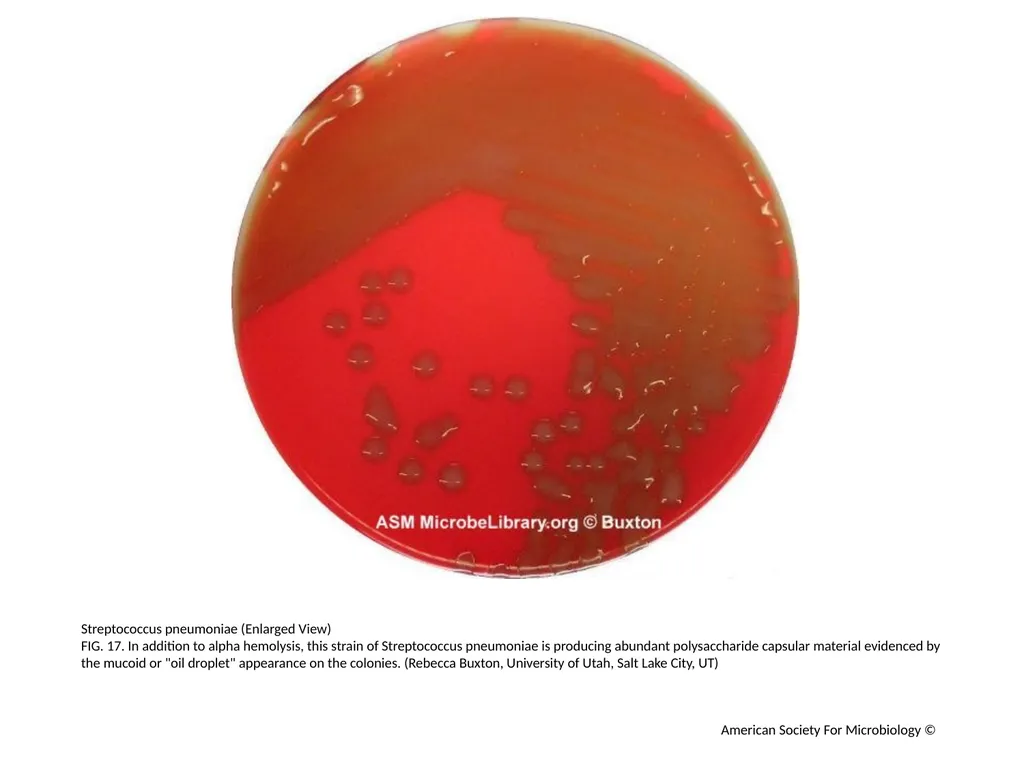Blood Agar Plates and Hemolysis: Streptococcus - slide 18 of 44