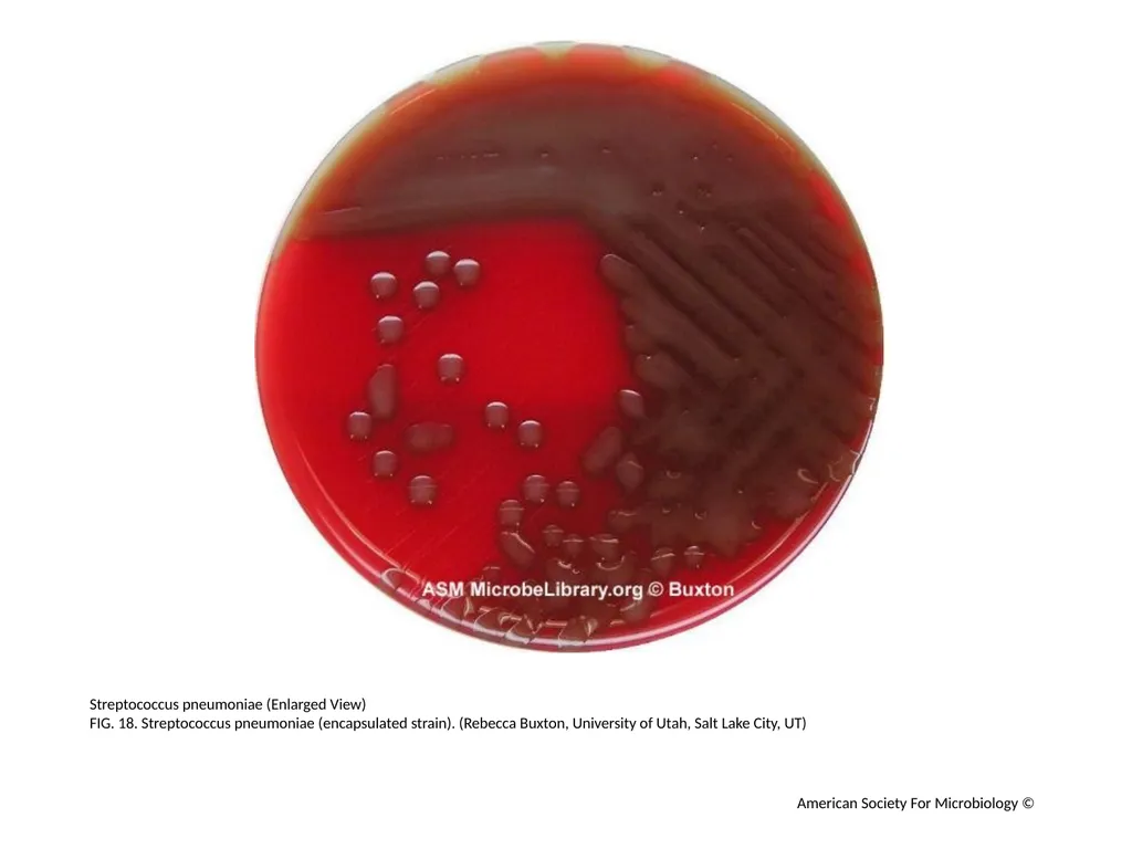 Blood Agar Plates and Hemolysis: Streptococcus - slide 19 of 44