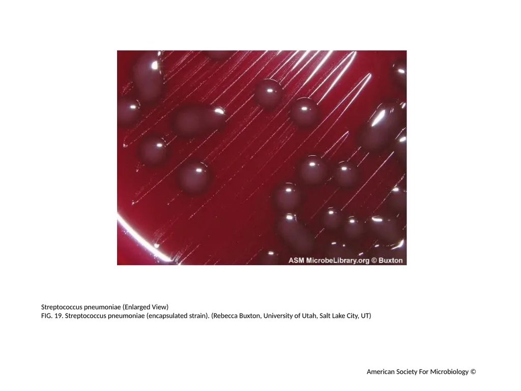 Blood Agar Plates and Hemolysis: Streptococcus - slide 20 of 44