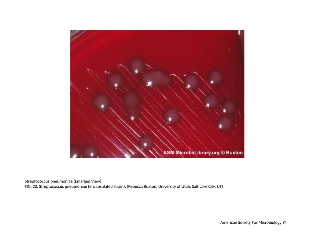 Blood Agar Plates and Hemolysis: Streptococcus - slide 21 of 44
