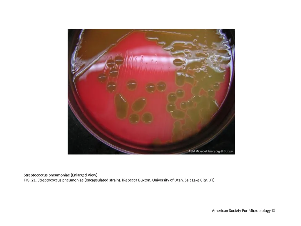 Blood Agar Plates and Hemolysis: Streptococcus - slide 22 of 44