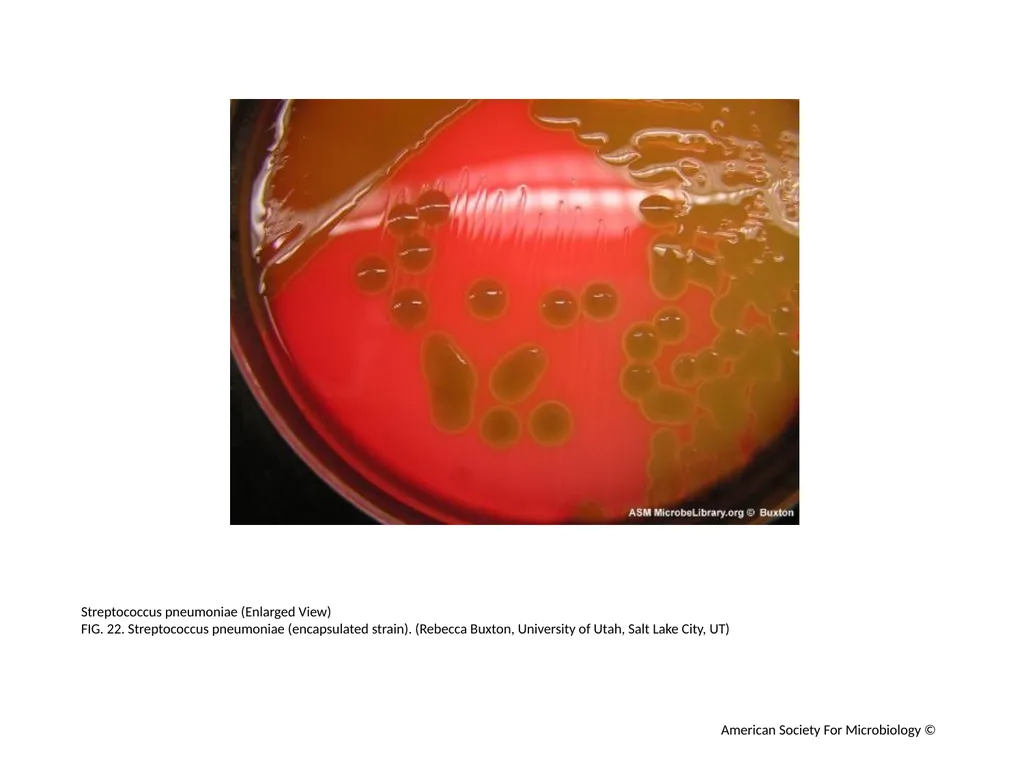 Blood Agar Plates and Hemolysis: Streptococcus - slide 23 of 44