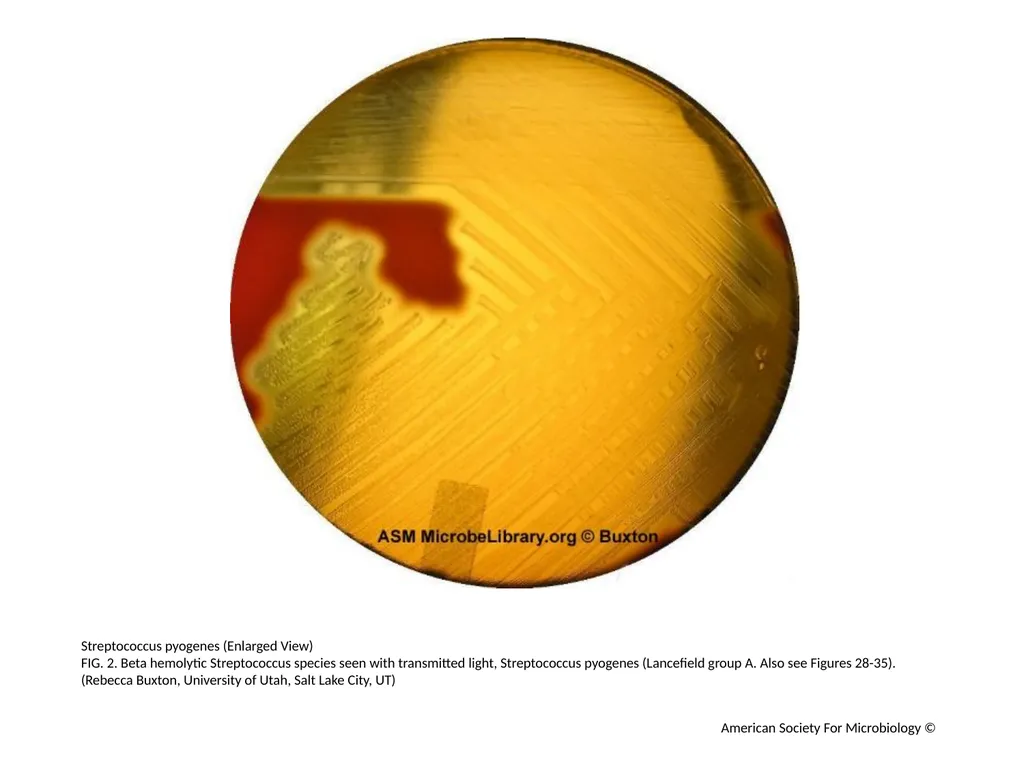 Blood Agar Plates and Hemolysis: Streptococcus - slide 3 of 44