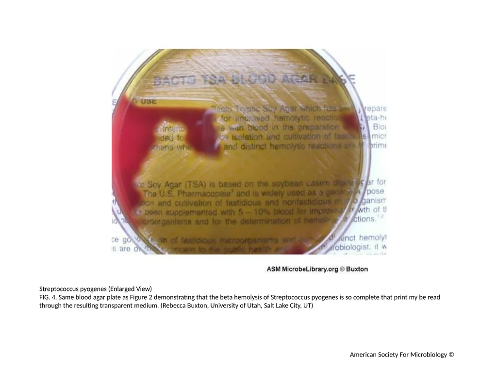 Blood Agar Plates and Hemolysis: Streptococcus - slide 5 of 44