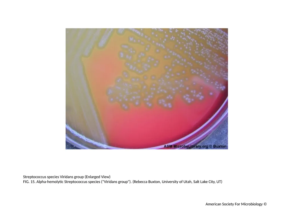 Blood Agar Plates and Hemolysis: Streptococcus - slide 16 of 44